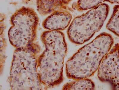 Immunohistochemistry: GDF-15 Antibody (8E5) [NBP3-15139]