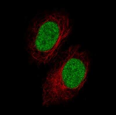 Immunocytochemistry/ Immunofluorescence: GDF-15 Antibody (CL0328) [NBP2-52917]