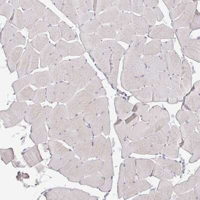 Immunohistochemistry-Paraffin: GDF-15 Antibody (CL0328) [NBP2-52917]