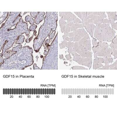 Immunohistochemistry-Paraffin: GDF-15 Antibody (CL0328) [NBP2-52917]