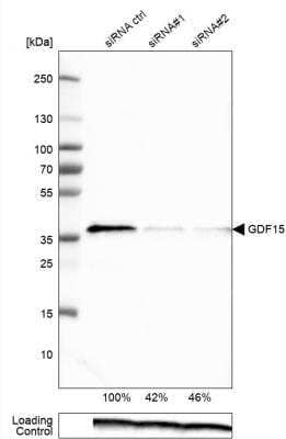 Western Blot: GDF-15 Antibody (CL0328) [NBP2-52917]