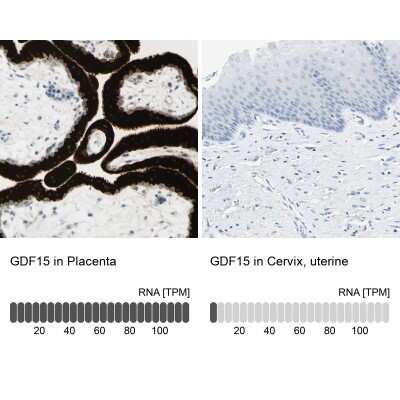 Immunohistochemistry-Paraffin: GDF-15 Antibody [NBP1-81050]