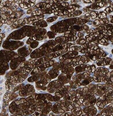 Immunohistochemistry-Paraffin: GDF-3 Antibody [NBP1-86443]