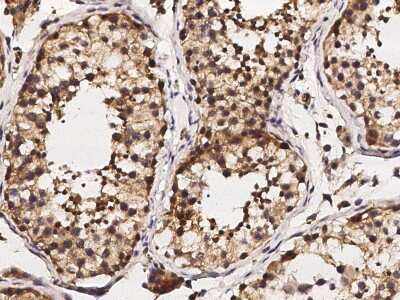 Immunohistochemistry-Paraffin: GDF-3 Antibody [NBP2-98686]