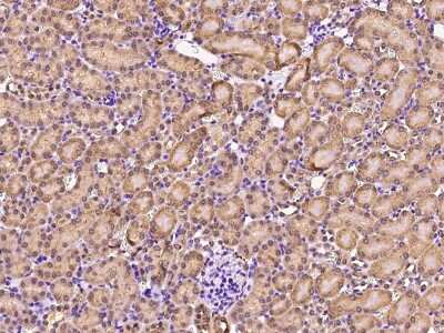 Immunohistochemistry-Paraffin: GDF-3 Antibody [NBP2-99527]