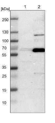 Western Blot: GDF-5/BMP-14 Antibody [NBP1-88575]