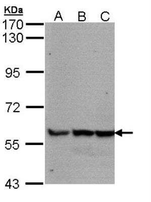 Western Blot: GDF-5/BMP-14 Antibody [NBP2-16632]