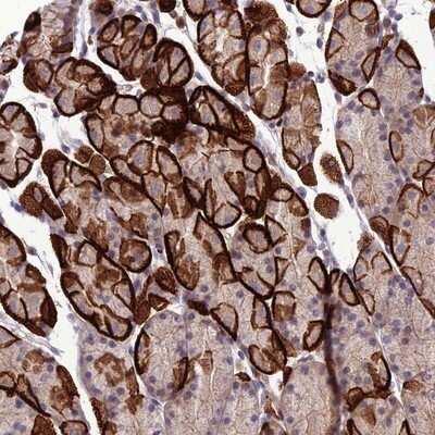 Immunohistochemistry-Paraffin: GDF-6/BMP-13 Antibody [NBP1-91934]