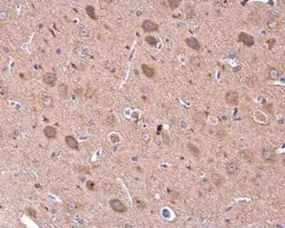 Immunohistochemistry-Paraffin: GDF-6/BMP-13 Antibody [NBP3-13007]