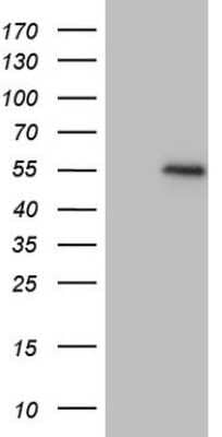 Western Blot: GDF-8/Myostatin Antibody (OTI7H5) [NBP2-46025]