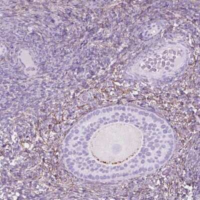 Immunohistochemistry: GDF-9 Antibody [NBP2-49589]