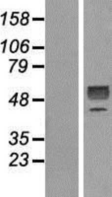 Western Blot: GDF-9 Overexpression Lysate [NBP2-10477]