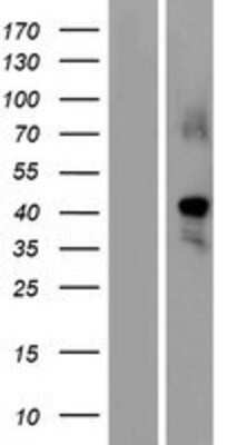 Western Blot: GDF-1 Overexpression Lysate [NBP2-08199]