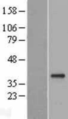 Western Blot: GDF-15 Overexpression Lysate [NBL1-11024]