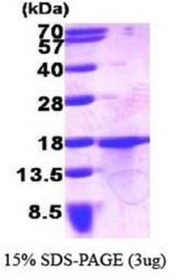 SDS-PAGE: Recombinant Human GDF-15 His Protein [NBP1-30273]