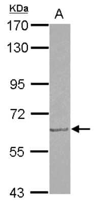 Western Blot: GDF-5/BMP-14 Antibody [NBP2-16631]