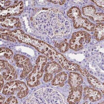 Immunohistochemistry-Paraffin: GDF5OS Antibody [NBP2-32368]