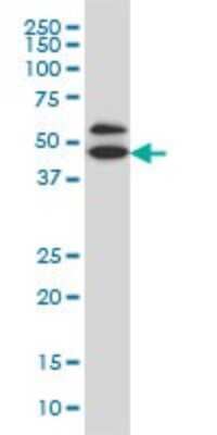 Western Blot: GDI1 Antibody (1H3) [H00002664-M08]