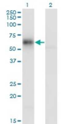 Western Blot: GDI1 Antibody (1H3) [H00002664-M08]