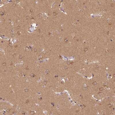 Immunohistochemistry: GDI1 Antibody [NBP2-49264]