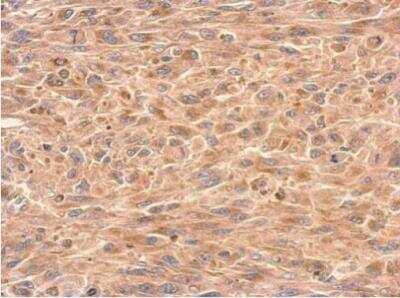 Immunohistochemistry-Paraffin: GDI1 Antibody [NBP1-31528]