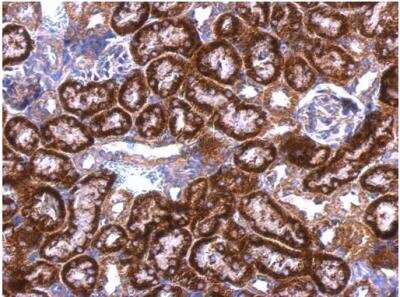 Immunohistochemistry-Paraffin: GDI1 Antibody [NBP1-31528]