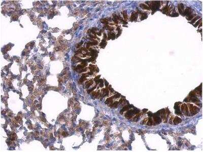 Immunohistochemistry-Paraffin: GDI1 Antibody [NBP1-31528]