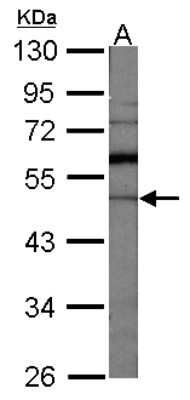 Western Blot: GDI1 Antibody [NBP1-31528]