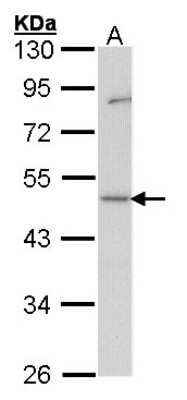 Western Blot: GDI1 Antibody [NBP1-31528]