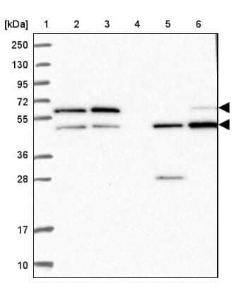 Western Blot: GDI1 Antibody [NBP2-14041]