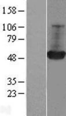 Western Blot: GDI1 Overexpression Lysate [NBL1-11029]