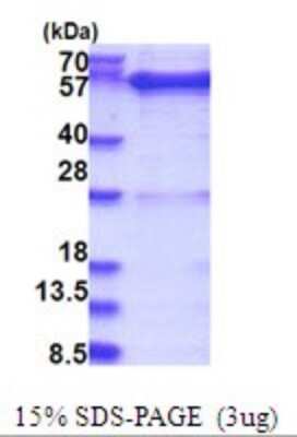 SDS-PAGE: Recombinant Human GDI1 His Protein [NBP2-51702]