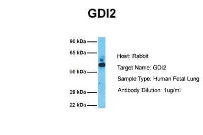 Western Blot: GDI2 Antibody [NBP2-84039]