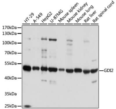 Western Blot: GDI2 AntibodyBSA Free [NBP3-03650]