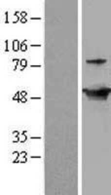 Western Blot: GDI2 Overexpression Lysate [NBL1-11030]