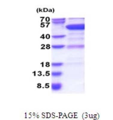 SDS-PAGE: Recombinant Human GDI2 His Protein [NBP2-51667]