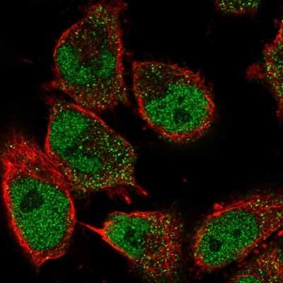 Immunocytochemistry/ Immunofluorescence: GDNF Antibody [NBP2-56036]