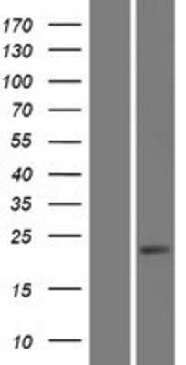 Western Blot: GDNF Overexpression Lysate [NBP2-09015]