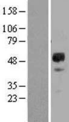 Western Blot: GFR alpha-2/GDNF R alpha-2 Overexpression Lysate [NBL1-11052]