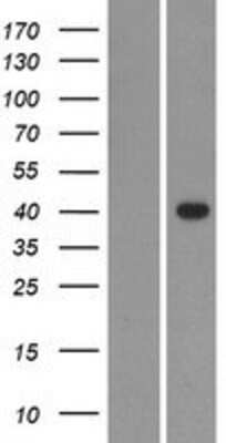 Western Blot: GDPD1 Overexpression Lysate [NBP2-04850]