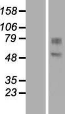 Western Blot: GDPD2 Overexpression Lysate [NBL1-11033]