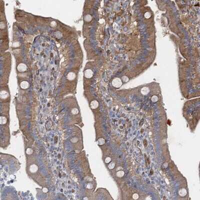 Immunohistochemistry-Paraffin: GDPD3 Antibody [NBP1-81081]