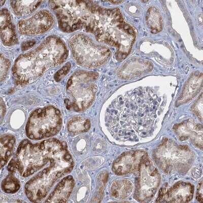 Immunohistochemistry-Paraffin: GDPD3 Antibody [NBP1-81081]