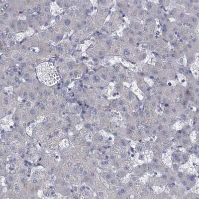 Immunohistochemistry-Paraffin: GDPD3 Antibody [NBP1-81081]