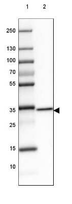 Western Blot: GDPD3 Antibody [NBP1-81081]