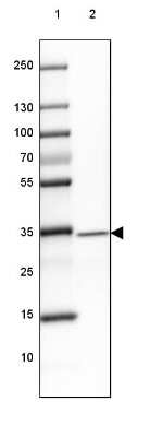 Western Blot: GDPD3 Antibody [NBP1-81082]