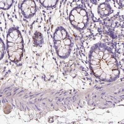 Immunohistochemistry: GDPD5 Antibody [NBP2-49492]