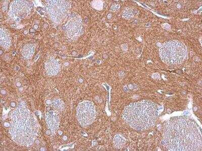 Immunohistochemistry-Paraffin: GEF-H1 Antibody (1132) [NBP2-43584]