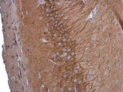 Immunohistochemistry-Paraffin: GEF-H1 Antibody (1132) [NBP2-43584]