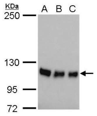 Western Blot: GEF-H1 Antibody (1132) [NBP2-43584]